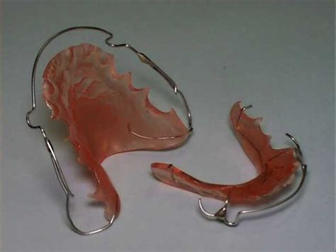 Pendakap gigi adalah alat yang digunakan dalam ortodontik yang menyelaraskan dan meluruskan gigi dan membantu memposisikan semula kebolehan mengigit seseorang. Otakkukusut: kawat gigi 3