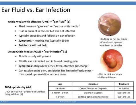 Acute Otitis Media Vs Otitis Media With Effusion