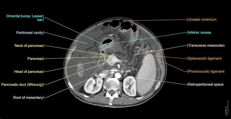 Abdominopelvic Cavity And Peritoneum Normal Anatomy E Anatomy