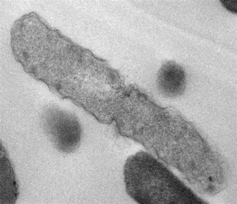 Dead Bacteria Microscopic Image Eurekalert Science News Releases