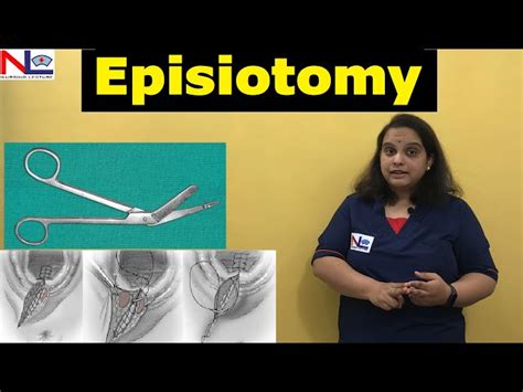 Episiotomy Perineotomy Nursing Lecture