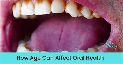 how age can affect oral health sky dental clinic