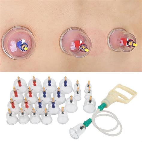 24pcs U Shape Cups Chinese Vacuum Cupping Set Massage Therapy Suction Acupuncture In Cupping