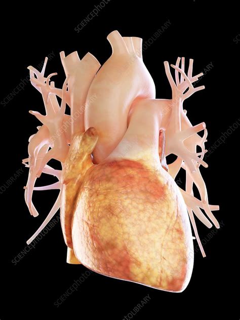 Illustration Of A Fatty Heart Stock Image F0234264 Science Photo