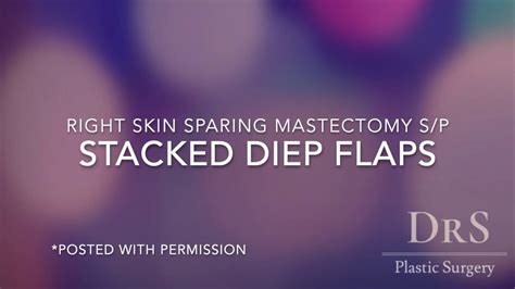 Stacked Diep Flaps For Mastectomy Breast Reconstruction Youtube