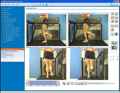 Biomechanical Assessment With Video Gait Analysis