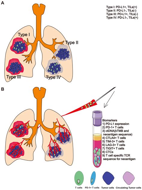 Liquid Biopsy For Lung Cancer Immunotherapy Review
