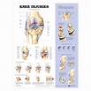 The Knee Injuries Anatomical Charts 20'' x 26''