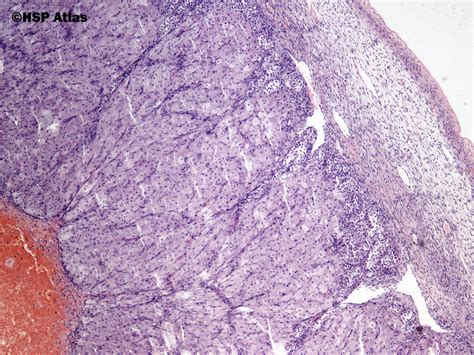 Hsp Atlas Histopathology Atlas Reproductive