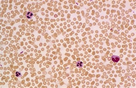 Lm Of A Field Of Red And White Blood Cells Stock Image P2480085