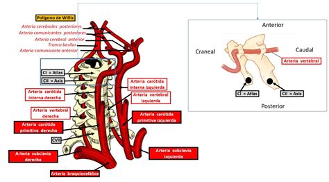 Arterias Vertebrales Dolopedia