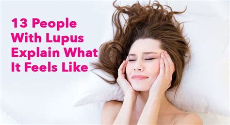 13 People With Lupus Explain What It Feels Like Lupus Facts Lupus