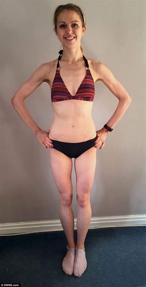 Anorexic Woman Overcame Illness After Her Boyfriend Wrote A List Of