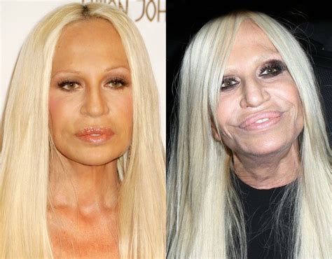 Donatella Versace In 2006 And On The Right On 2014 Celebrity Face