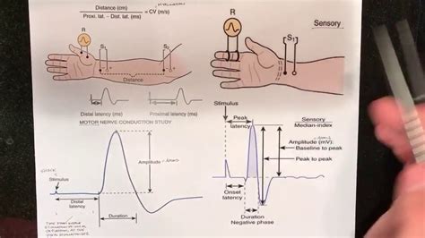 Nerve Conduction Studies Ncv Fundamentals Youtube