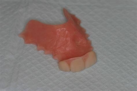 Flipper Interim Denture Advanced Dentistry And Dental Implant Center