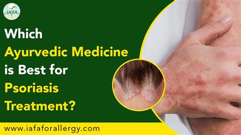 Which Ayurvedic Medicine Is Best For Psoriasis Treatment