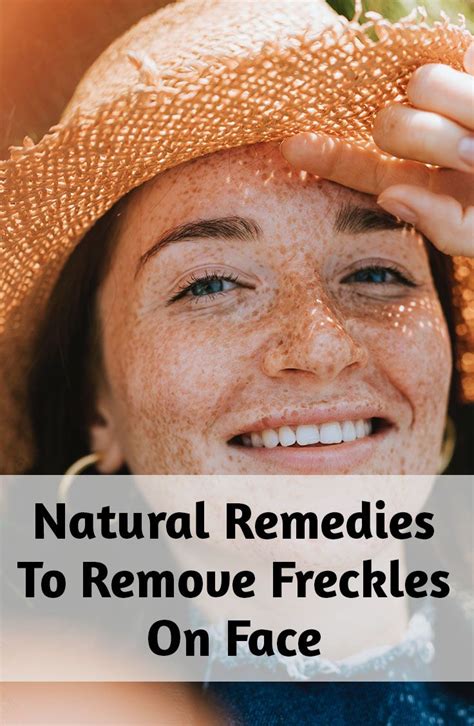 Natural Remedies To Remove Freckles On Face Getting Rid Of Freckles