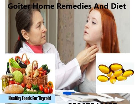 Goiter Home Remedies And Diet