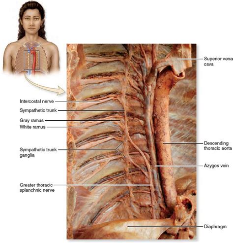Sympathetic Trunk An Anterolateral Photo Of The Right Side Of The Thoracic Cavity Shows The
