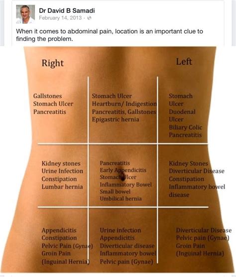 Abdominal Pain Chart Gallery Of Chart 2019