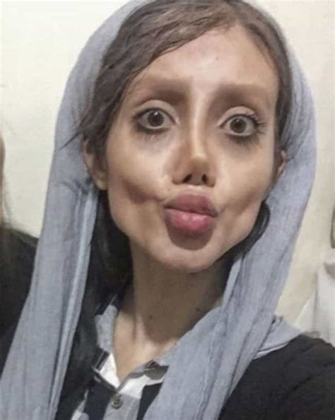 Remember Angelina Jolie Fan With 50 Surgical Procedures To Look Like