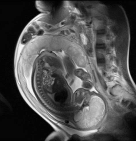 X Ray Of Pregnant Woman Radiología Imagenologia Embriologia Humana
