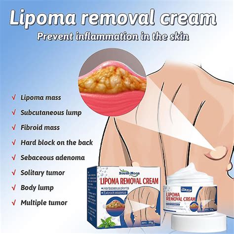 Lipoma Removal Cream Lipolysis Fat Lump Relief Plaster For Skin