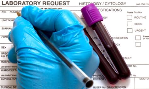 Healthiculture A Blood Test For Diagnosing Fibromyalgia