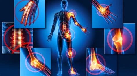 Fibromialgia i depresja są ściśle powiązane z aż 86 procentami cierpiących, u których oczekuje się epizodu dużej depresji w pewnym momencie ich życia, wynika z badań. Olej CBD a fibromialgia - informacje | Olejki CBD