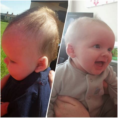 My Baby Has A Flat Head Coming From Carsons Mummy