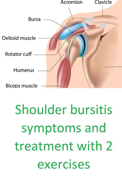 Shoulder Bursitis Symptoms And Treatment With Exercises