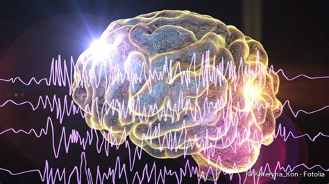 Epilepsie Beschreibung Formen Ursachen Behandlung Netdoktor