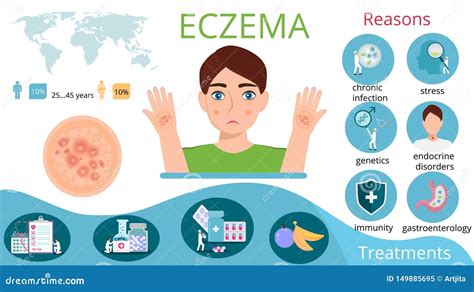 Infographics Of Eczema With Reasons Man Pills Stock Vector