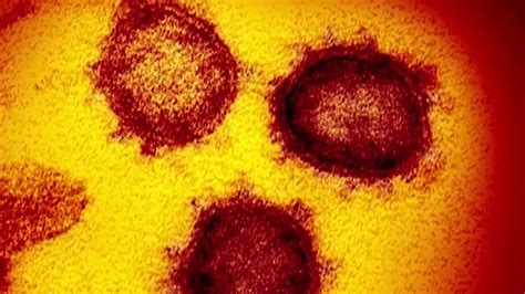 Fda Clears First Saliva Test To Diagnose Coronavirus On Air Videos