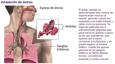 Ántrax Cuida Tu Salud Con Diane Pérez