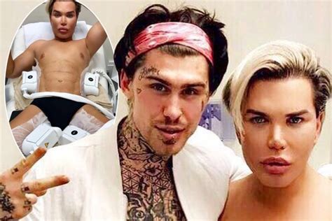 Marco Pierre White Jr Gets Surgery With The Human Ken Doll Ok Magazine