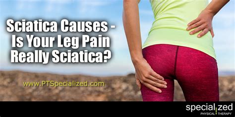 Sciatica Causes Is Your Leg Pain Really Sciatica