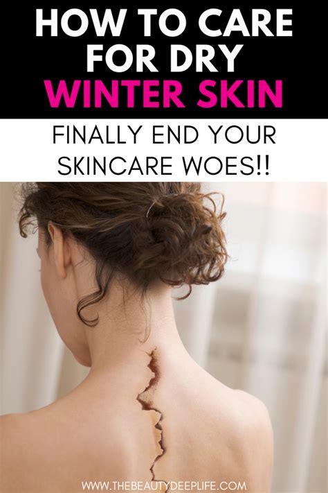 How To Care For Dry Winter Skin Finally End Your Winter Skincare Woes