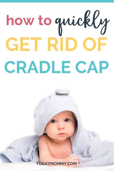 Cradle Cap Remedies Artofit