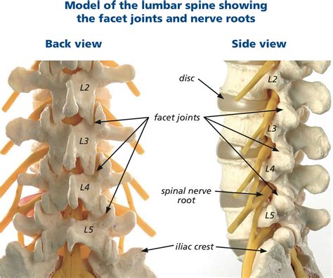 Lumbar Facet Syndrome Causes Symptoms Diagnosis Treatment And Prognosis