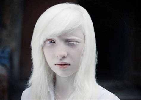 Nastya Zhidkova Pictures Beautiful Albinos Model Albino Girl Albino