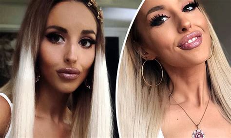 Mafs Reject Elizabeth Sobinoff Trolled Over Plump Pout As She Sparks