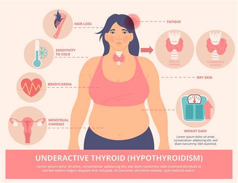 Frequently Asked Questions Faqs On Thyroid