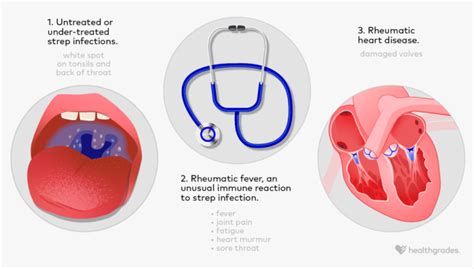 Rheumatic Heart Disease Symptoms Causes And Treatment
