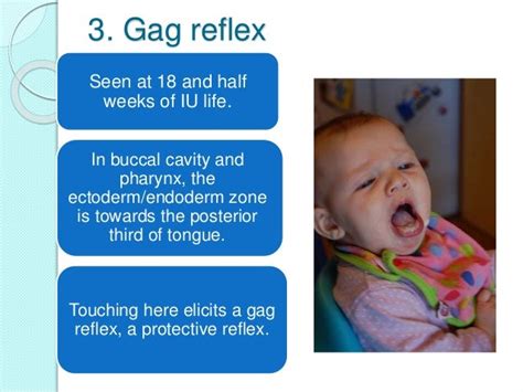 Reflexes Present In Infants