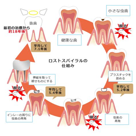 虫歯・歯周病予防 王子神谷おおぞら歯科｜感染予防対策・個室のある歯医者