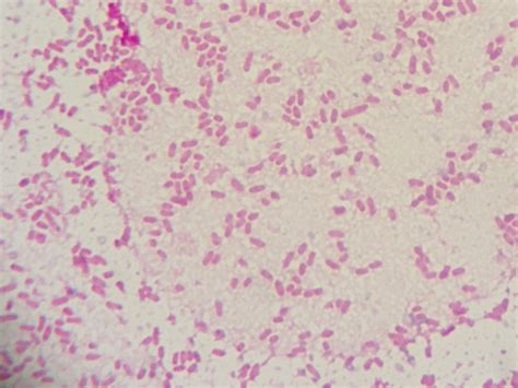 Campylobacter jejuni カンピロバクタージェジュナイ グラム染色 Gram Stain