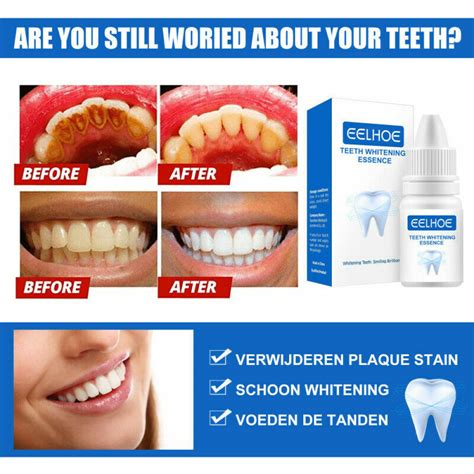 Teeth Whitening Essence Fast Remove Plaque Stains Whiten Serum