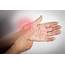 Hand Cramps Symptoms Causes And Home Remedies